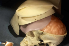 HumanTwinLabSkullB